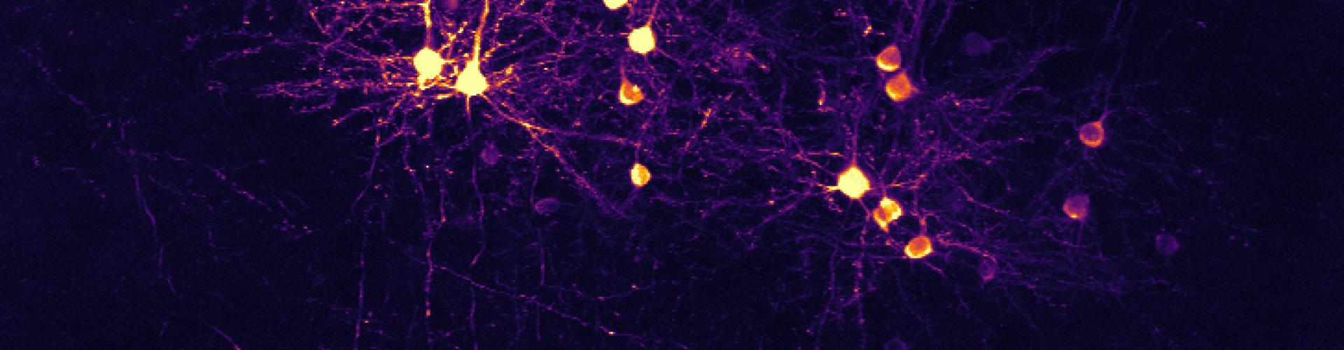 Primary visual cortex neurons projecting to higher visual area AL