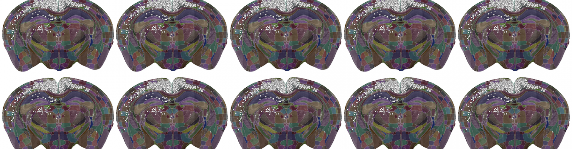 Single slices of 3 brain images showing detected cells 