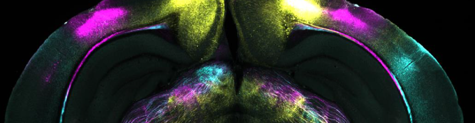 BRain slice showing projects in yellow, pink and blue