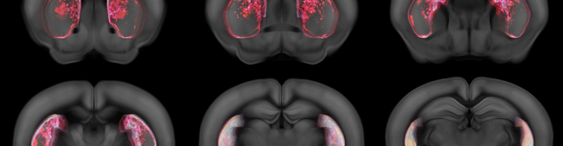 Triggered cell death in the tail of striatum using a viral strategy. Each image is an average projection of a part of the striatum. Areas are color coded based on their absence of neurons. Original colors are random to indicate the amount of animals that do not have cells on a particular region. The average projections then creates a mix of those original colours.