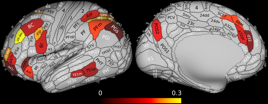 Multiple-demand cortex