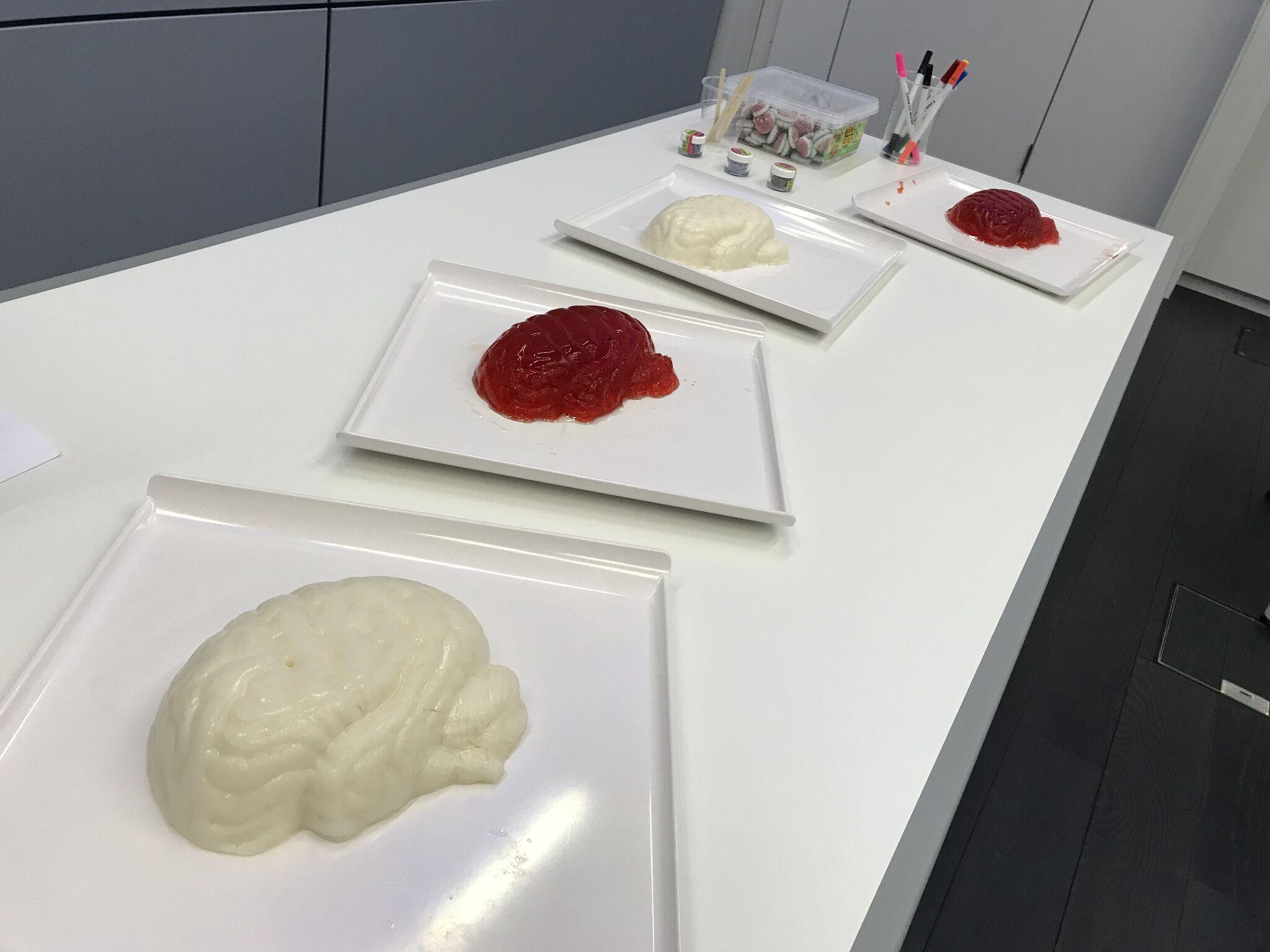Jelly brains