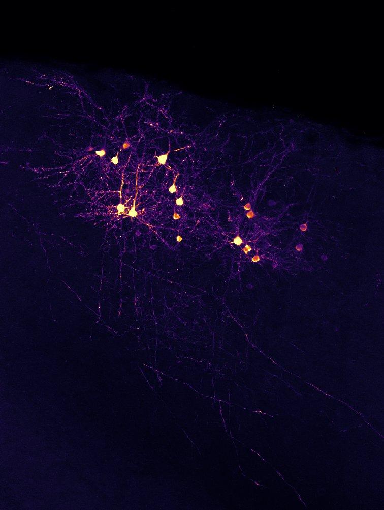 Primary visual cortex neurons projecting to higher visual area AL