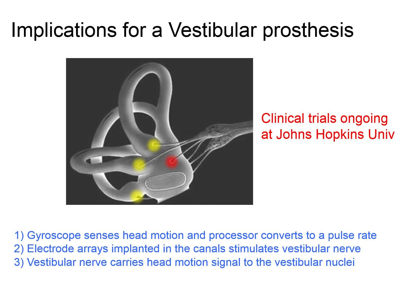 Vestibular prosthesis