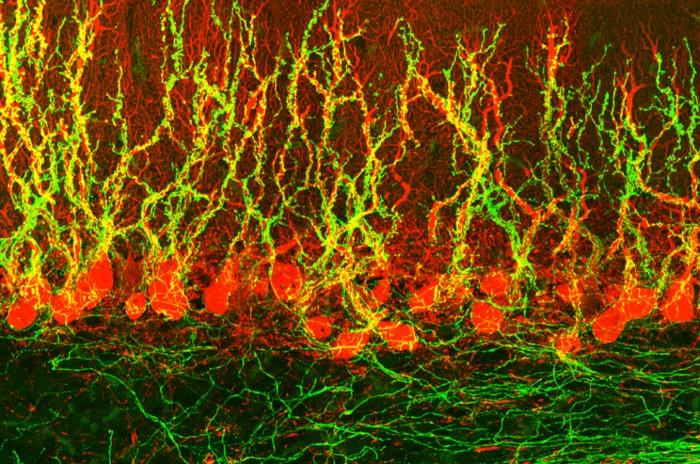 Tom Otis Cerebellum Micrograph