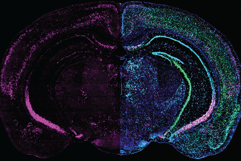 Brain slice - GRP expression (left) different cell markers (right)
