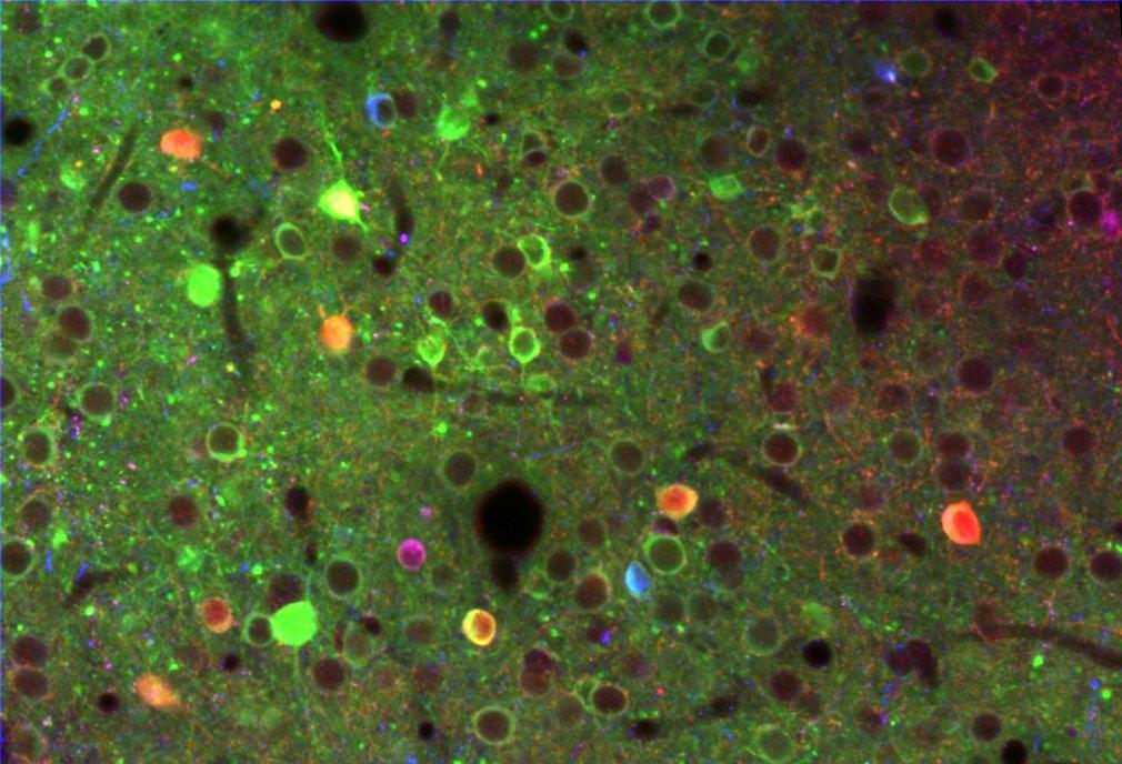 Excitatory neurons in green and inhibitory neurons in orange, blue and violet