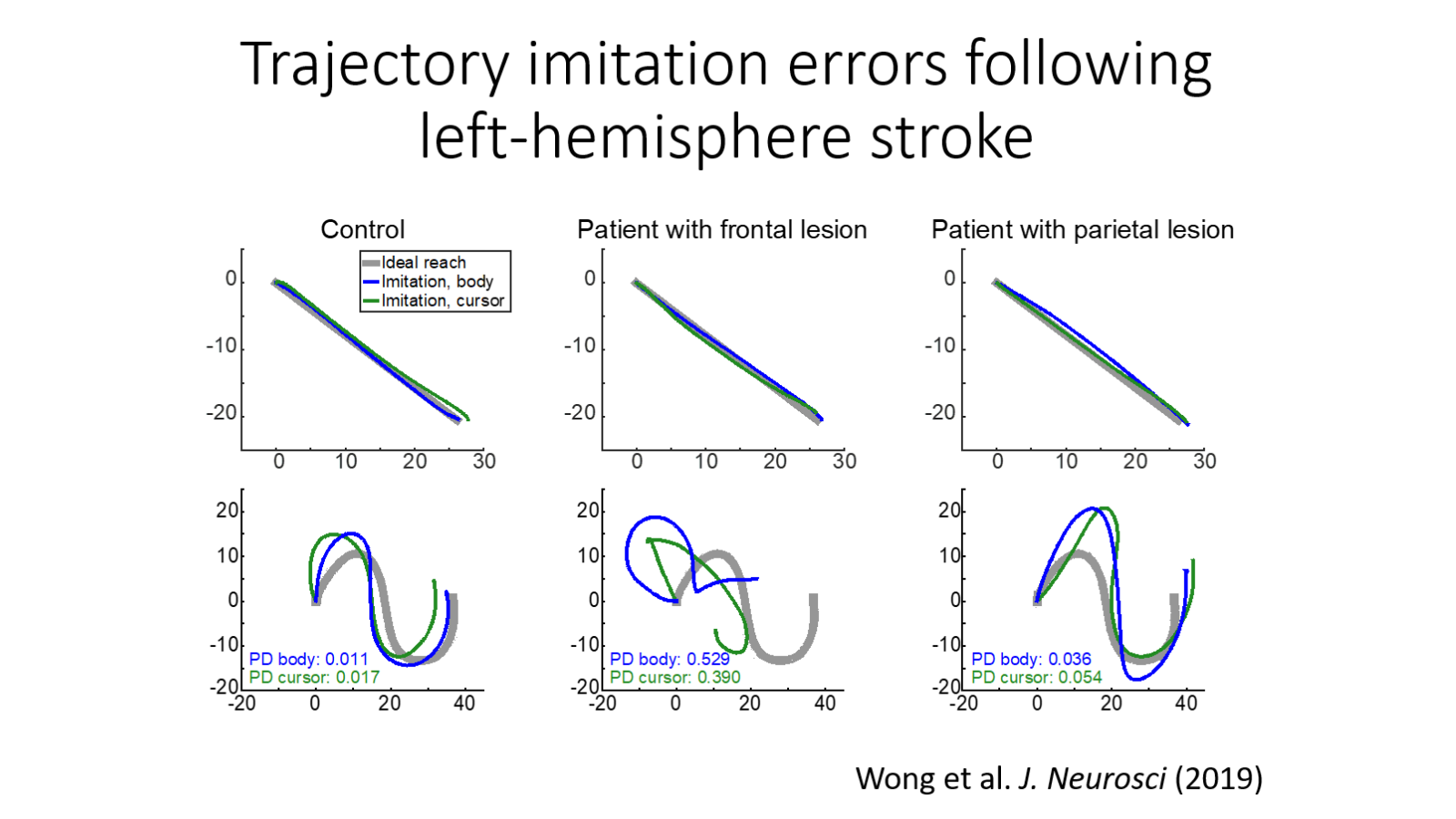 John Krakauer research image 3