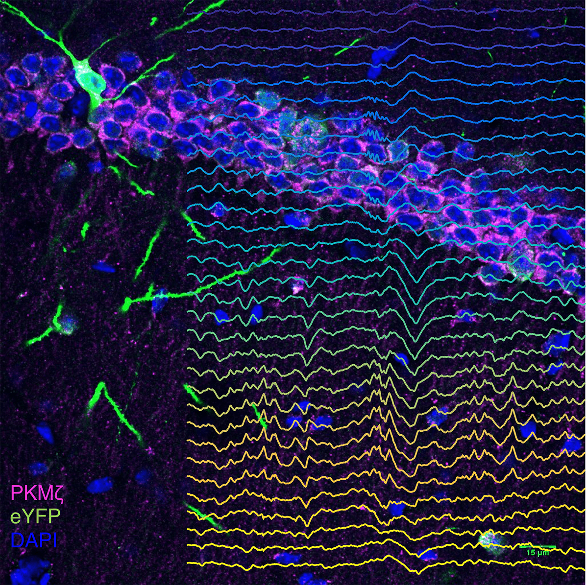 Andre Fenton research image cells