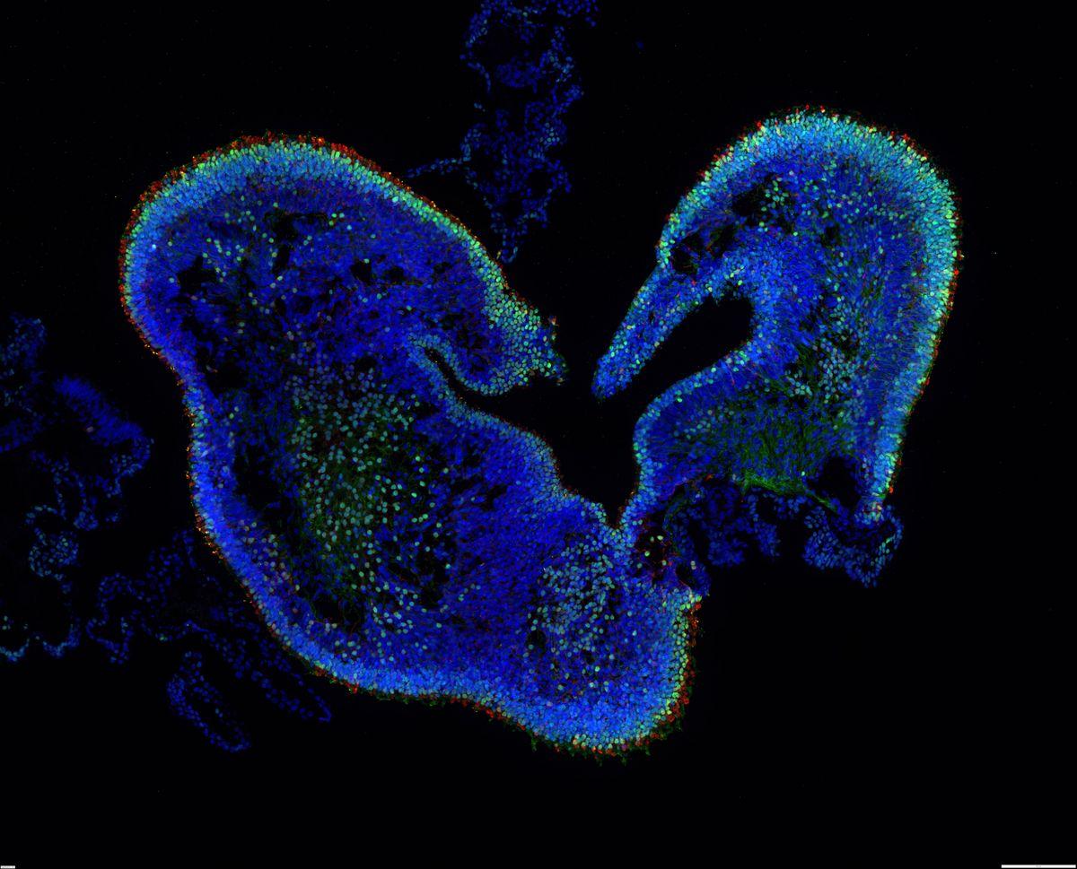 Retinal organoid - thin section