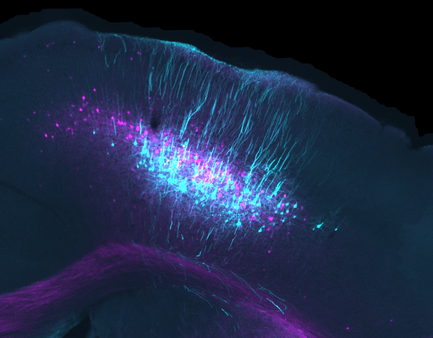 Image showing two populations of neurons in the motor cortex that relay information to the striatum.