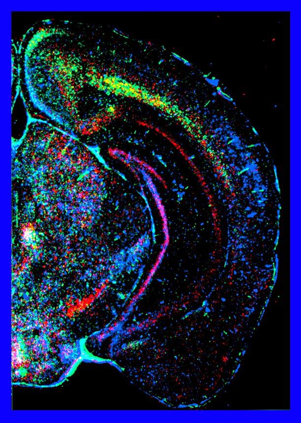 Colourful neuroscience image