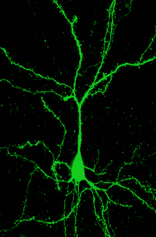 Image of a layer 5 pyramidal neuron in green
