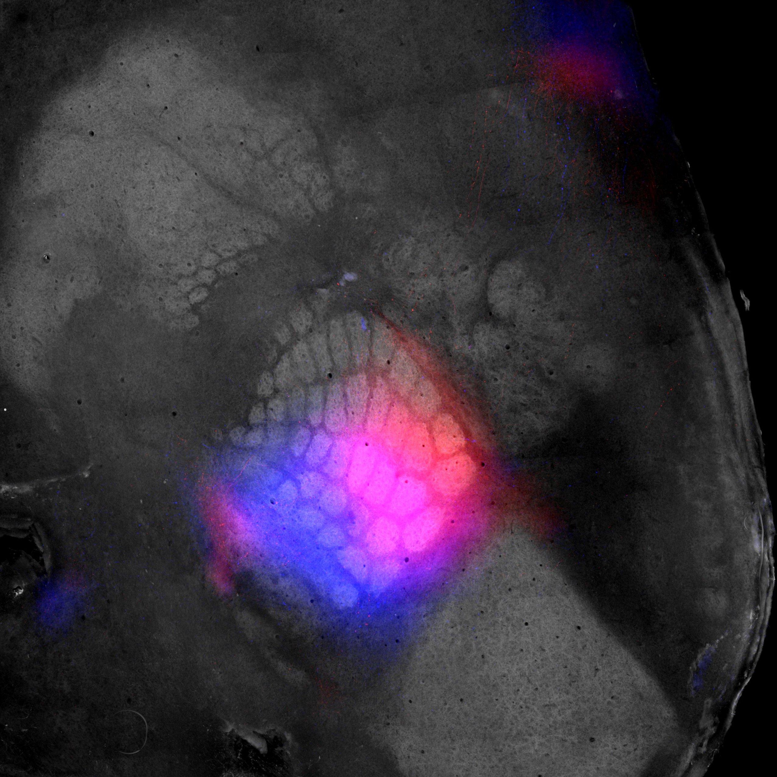 Reconstructed cortical surface obtained post-mortem using a flat-brain preparation.