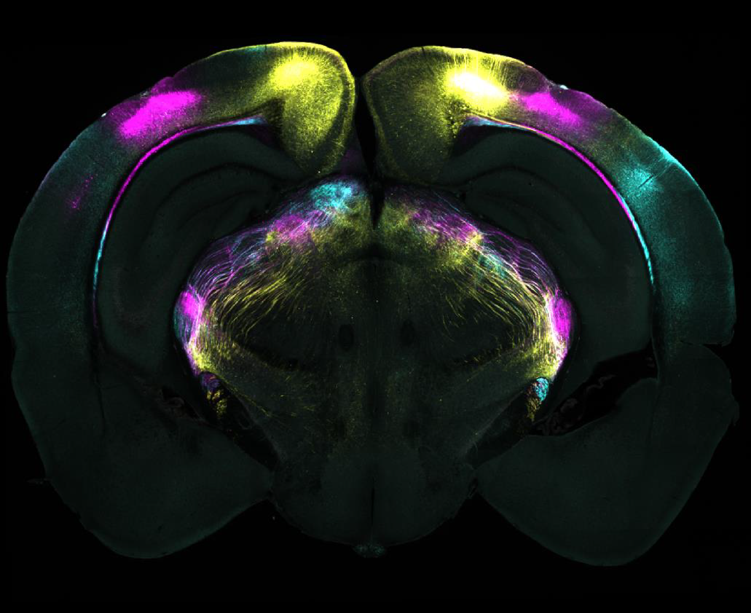 Brain slice showing projections in yellow, pink and blue