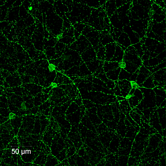 Melanopsin intrinsically photosensitive retinal ganglion cells (ipRGCs)