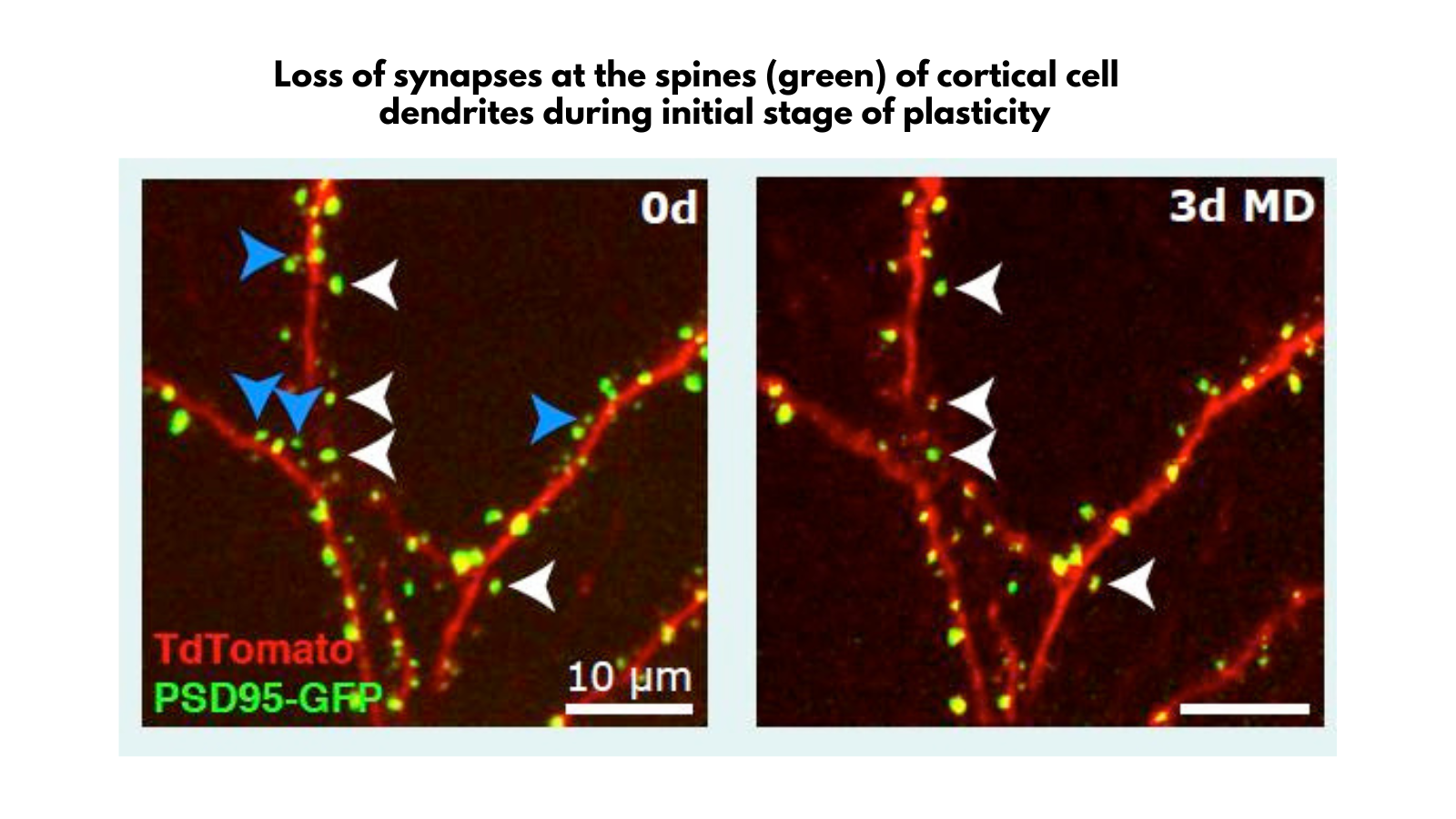 Image showing loss of synapses at the spines (green) of cortical cell dendrites during initial stage of plasticity
