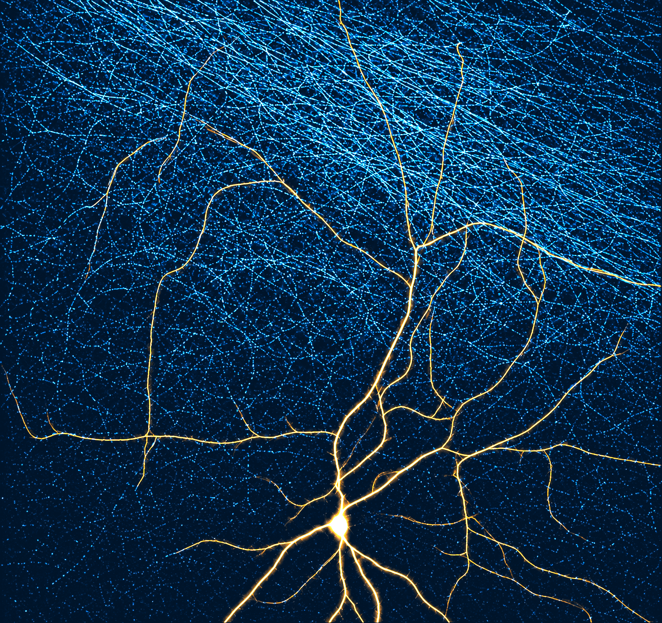 Image showing a dPAG neuron (gold) and surrounding input axonal fibres (cyan), reconstructed from original microscopy data