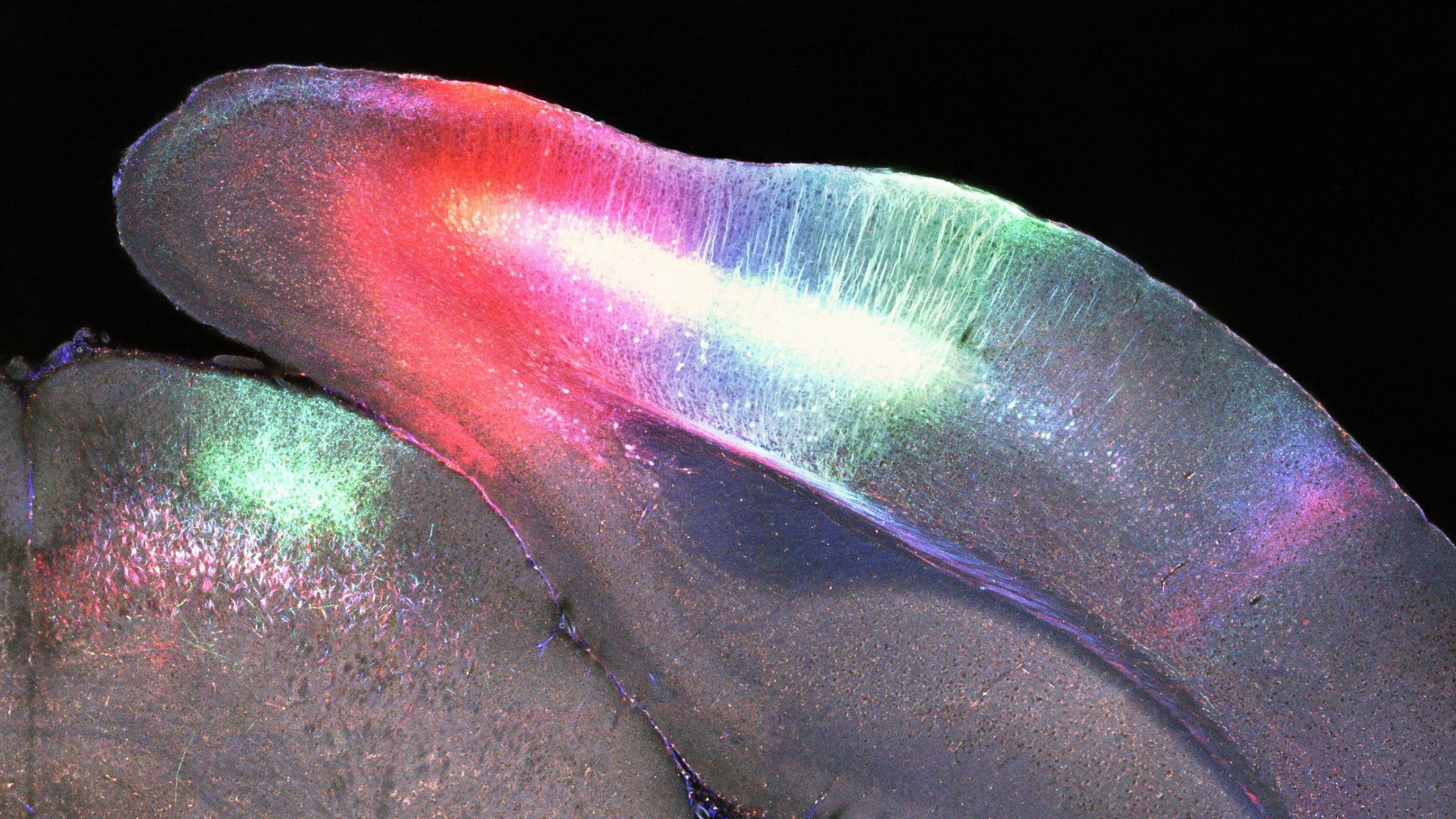Mouse brain BrainSaw - Rob Campbell - AMF