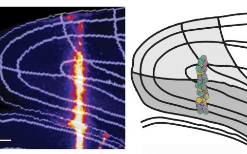 Angular head velocity recordings
