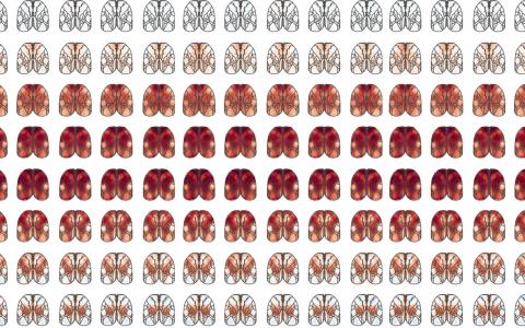 Widefield calcium responses across dorsal cortex in mice