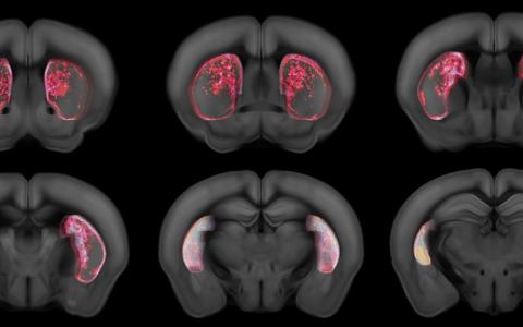 Triggered cell death in the tail of striatum using a viral strategy. Each image is an average projection of a part of the striatum. Areas are color coded based on their absence of neurons. Original colors are random to indicate the amount of animals that do not have cells on a particular region. The average projections then creates a mix of those original colours.