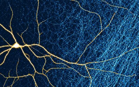 Image showing a dPAG neuron (gold) and surrounding input axonal fibres (cyan), reconstructed from original microscopy data