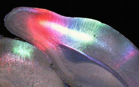 Mouse brain BrainSaw - Rob Campbell - AMF