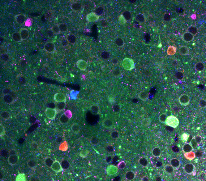 Immunostaining neuronal cell types