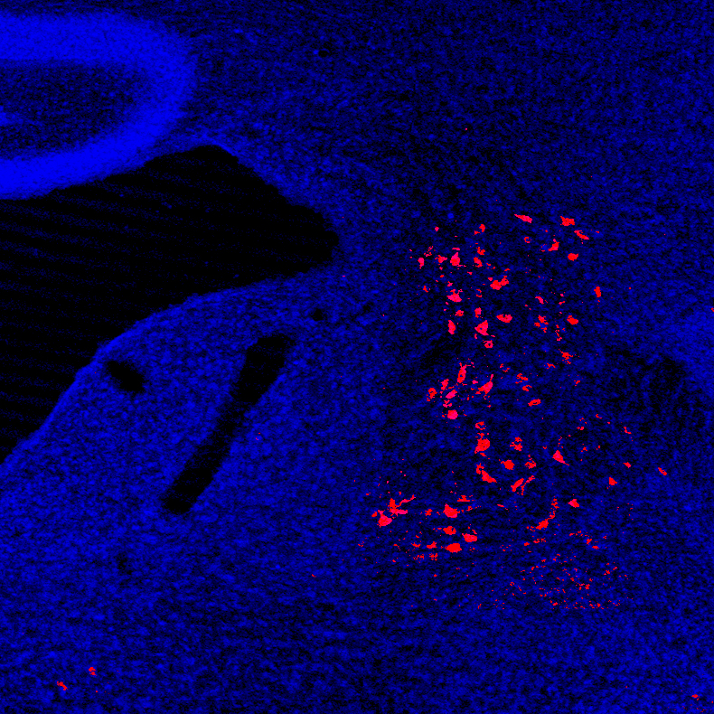 Neurons that project to the spinal cord