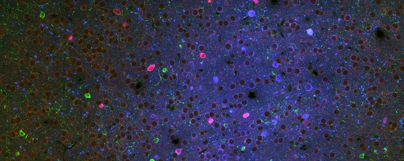 Neurons