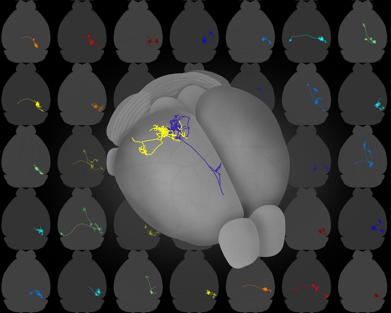 Whole brain imaging