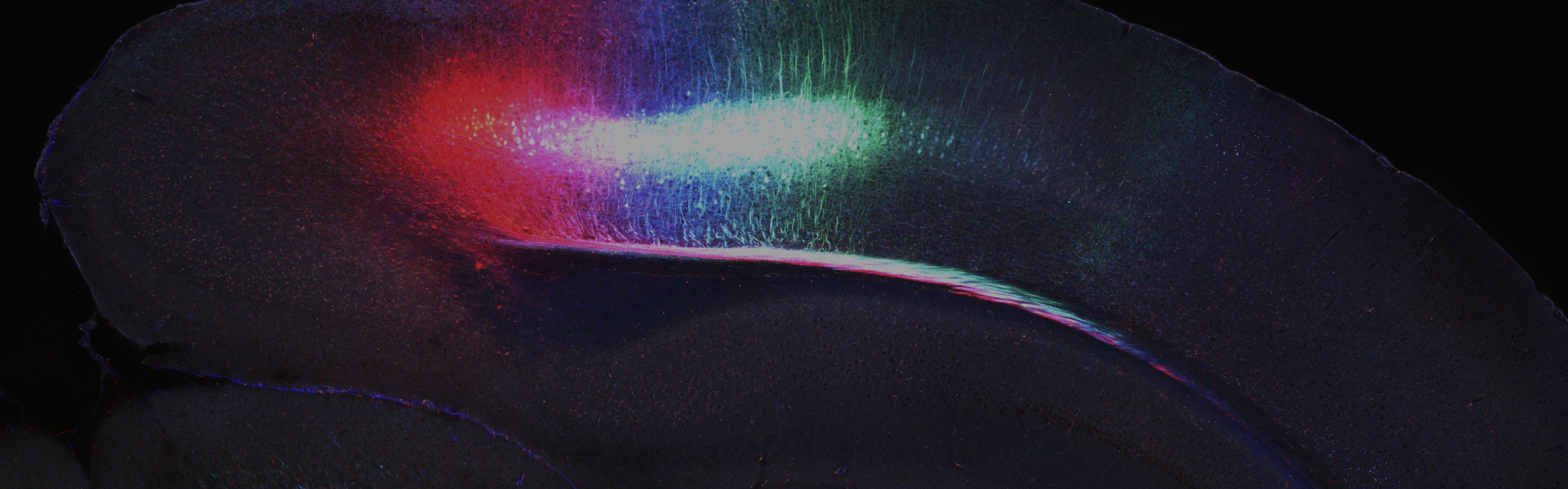 Brain