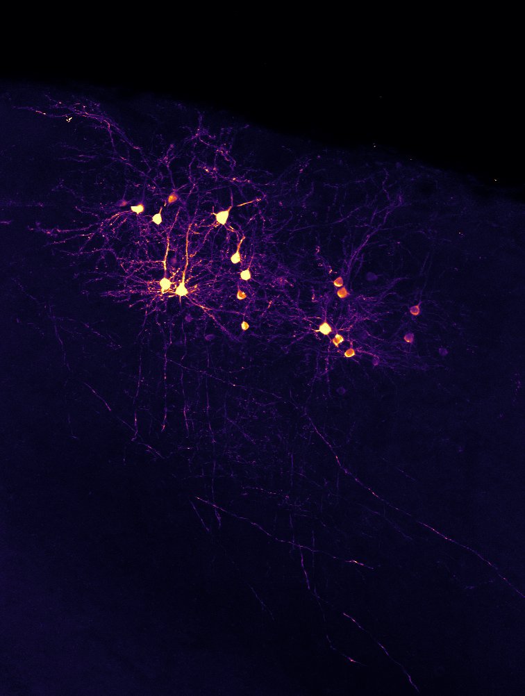Primary visual cortex neurons projecting to higher visual area AL