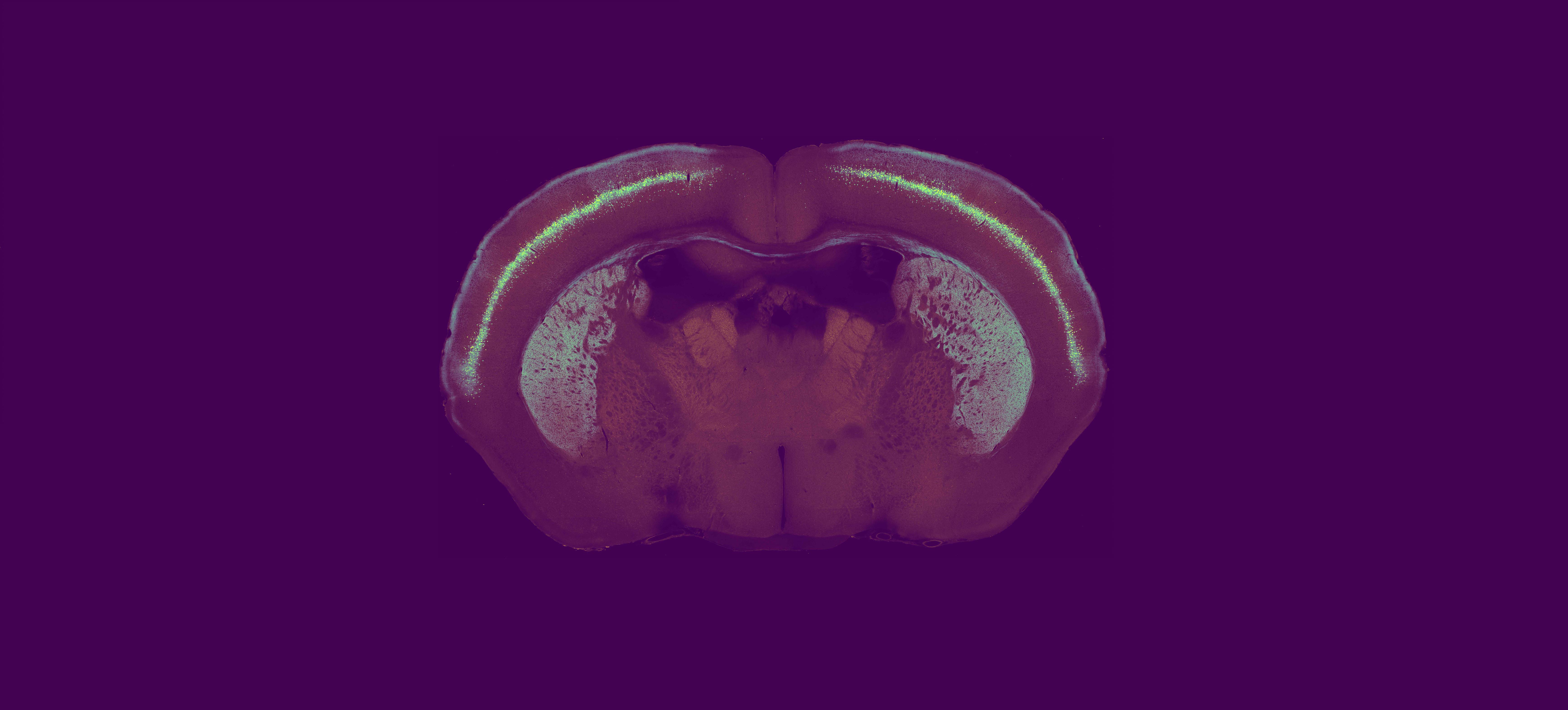 Brain slice