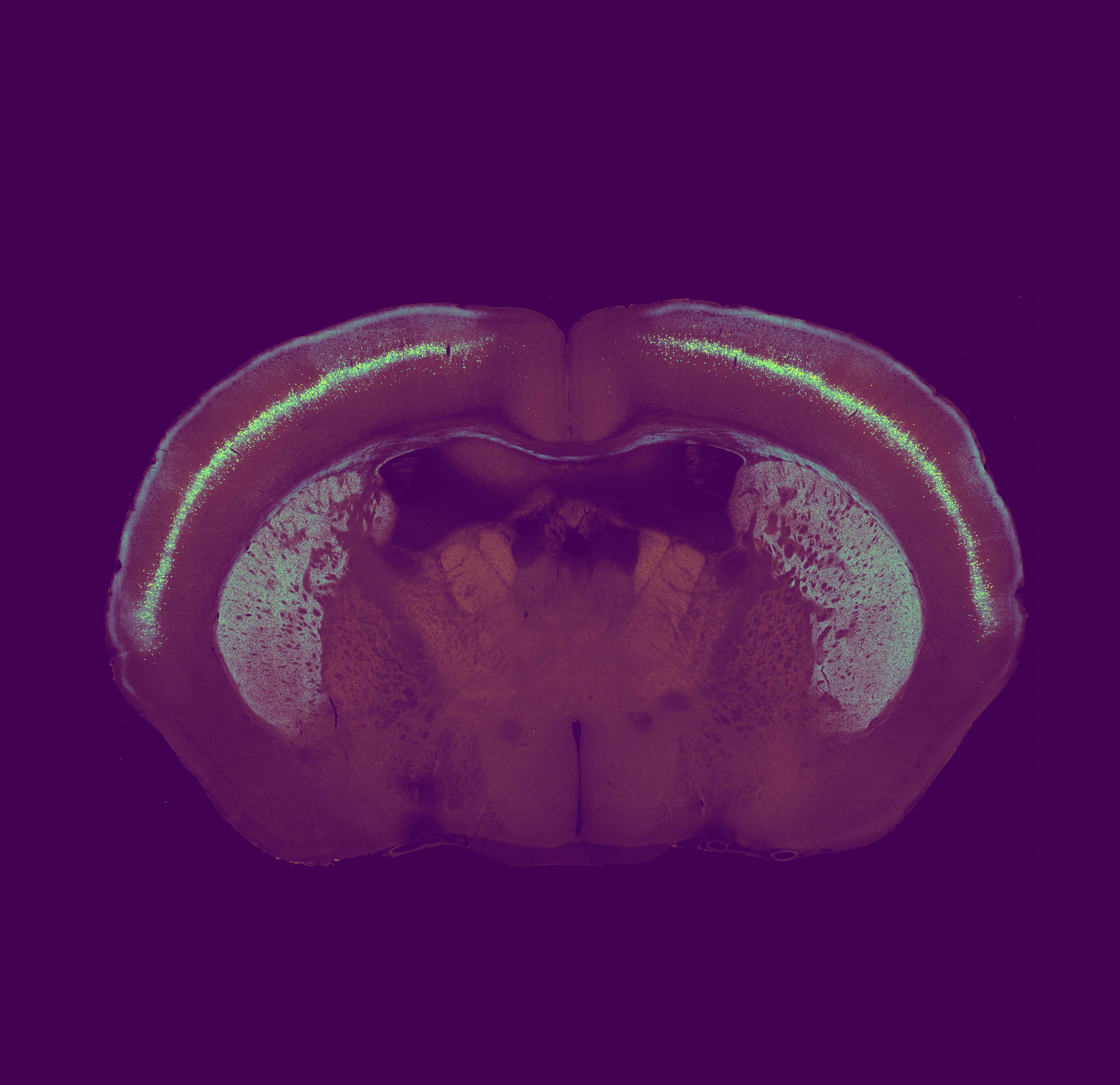 Brain slice