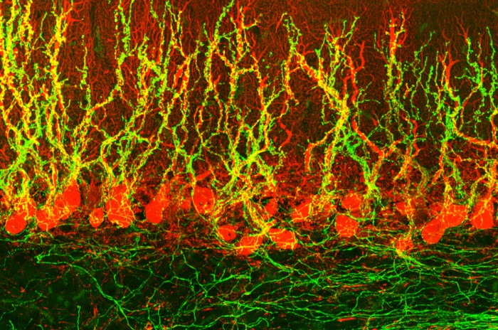 Tom Otis Cerebellum Micrograph Tom Otis Cerebellum Micrograph