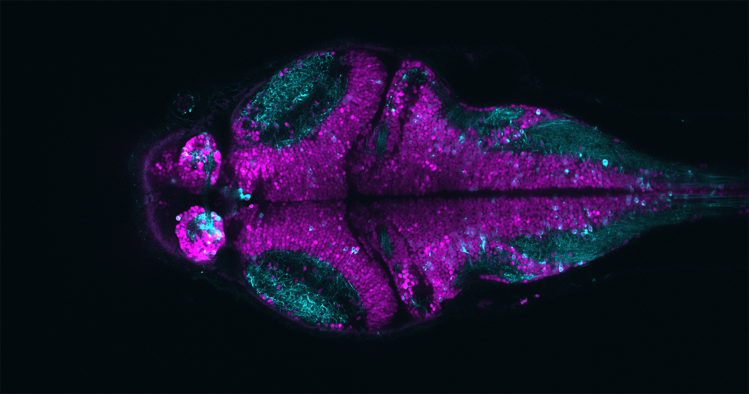 Neurons in zebrafish brain