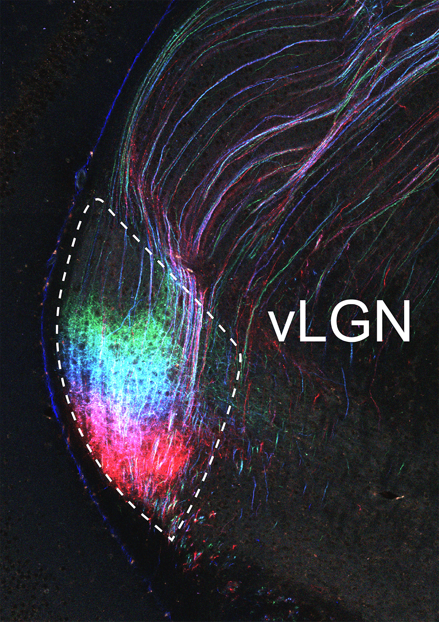 Fratzl et al Neuron Figure 3