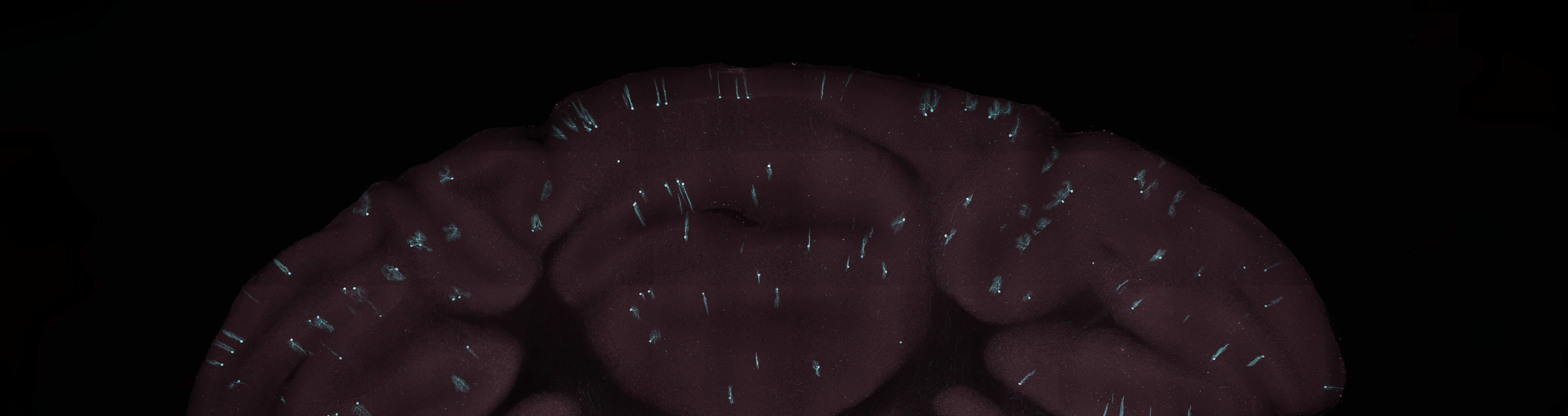 Brain slice section