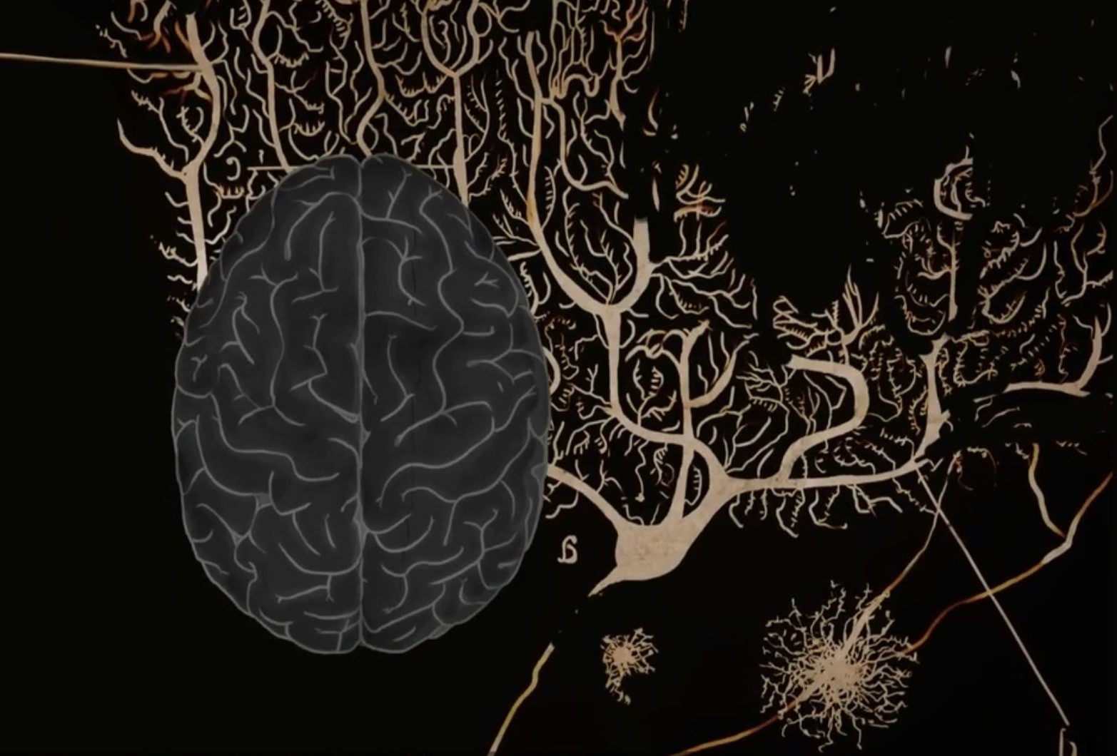 Sketch of brain and neurons