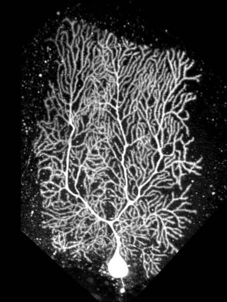 mouse cerebellar Purkinje neuron filled with the fluorescent dye OGB1