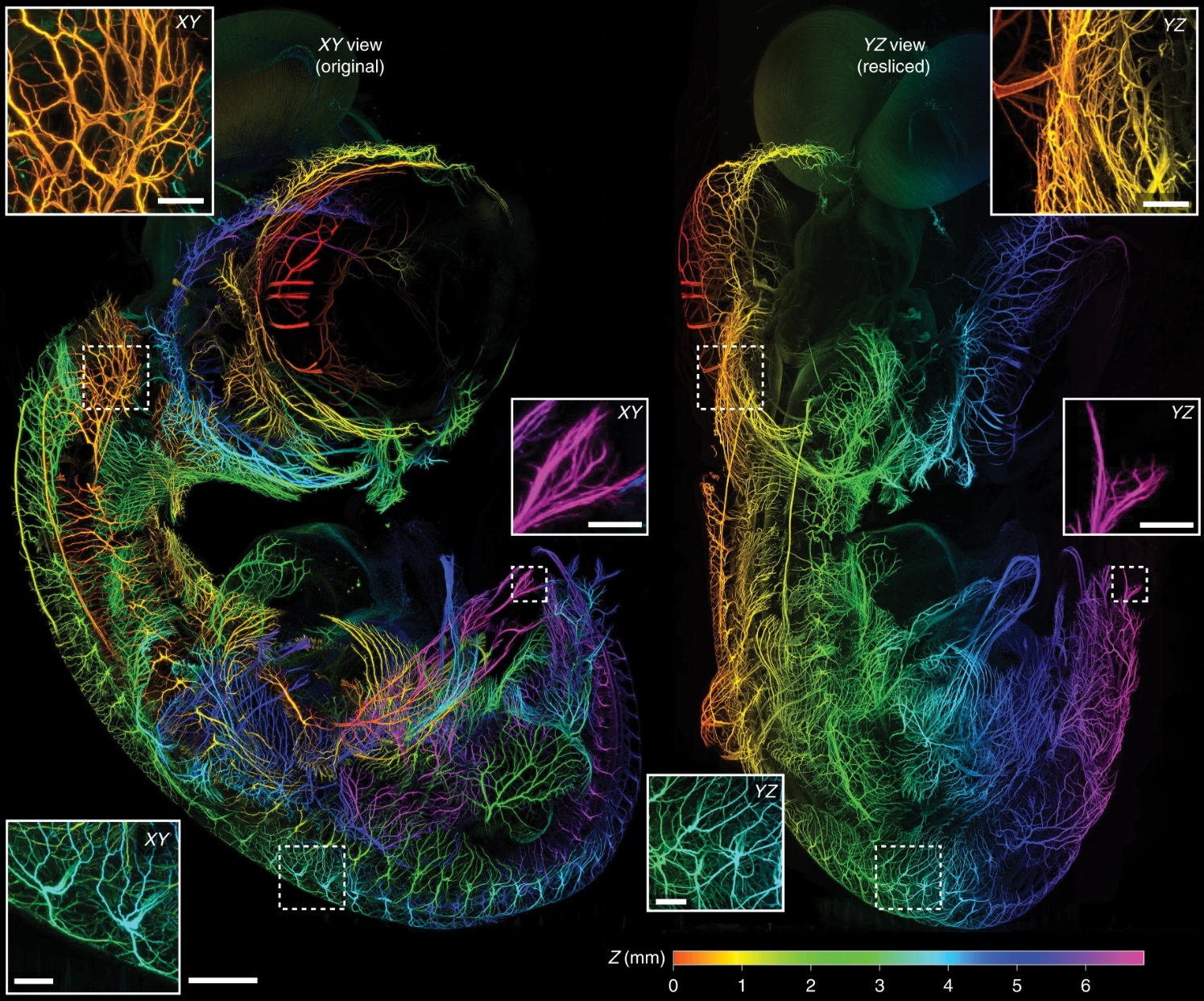 Large-scale dataset acquired with the mesoSPIM.