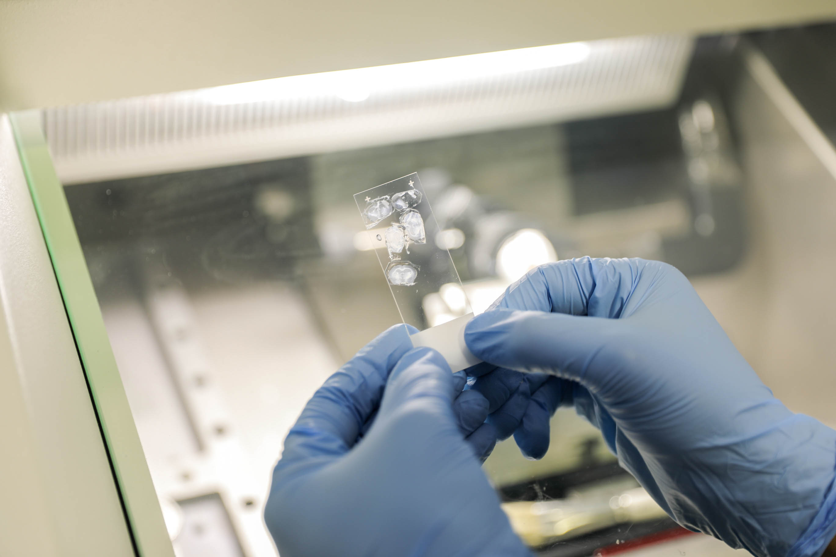 Gloved hands holding brain sample slide
