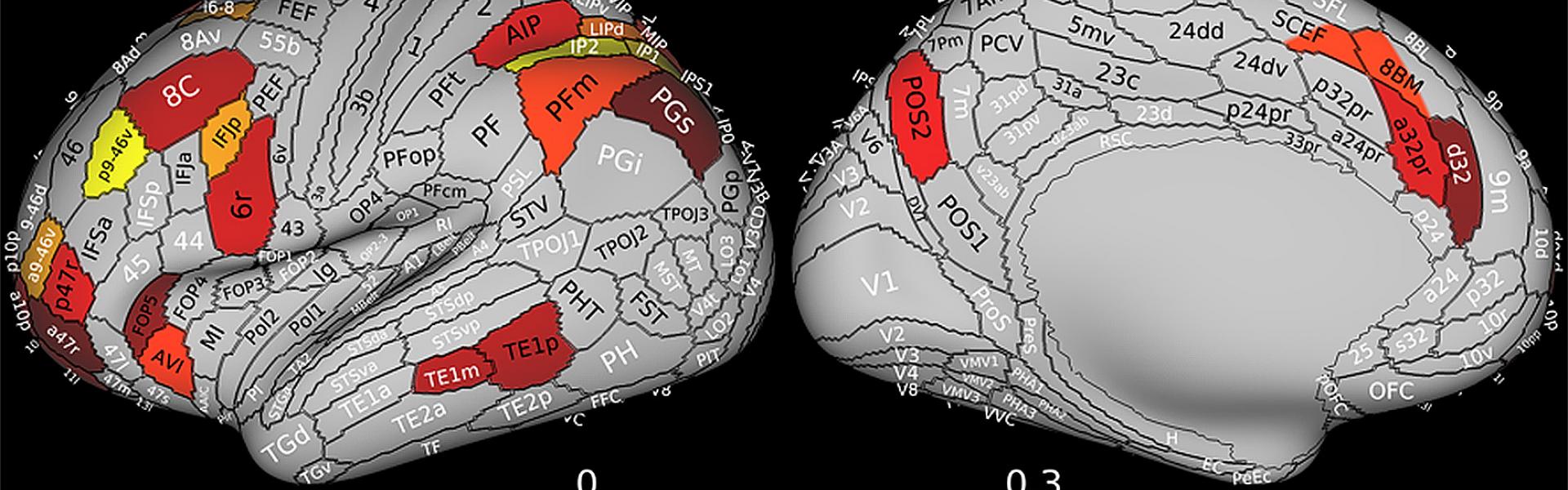 Multiple-demand cortex