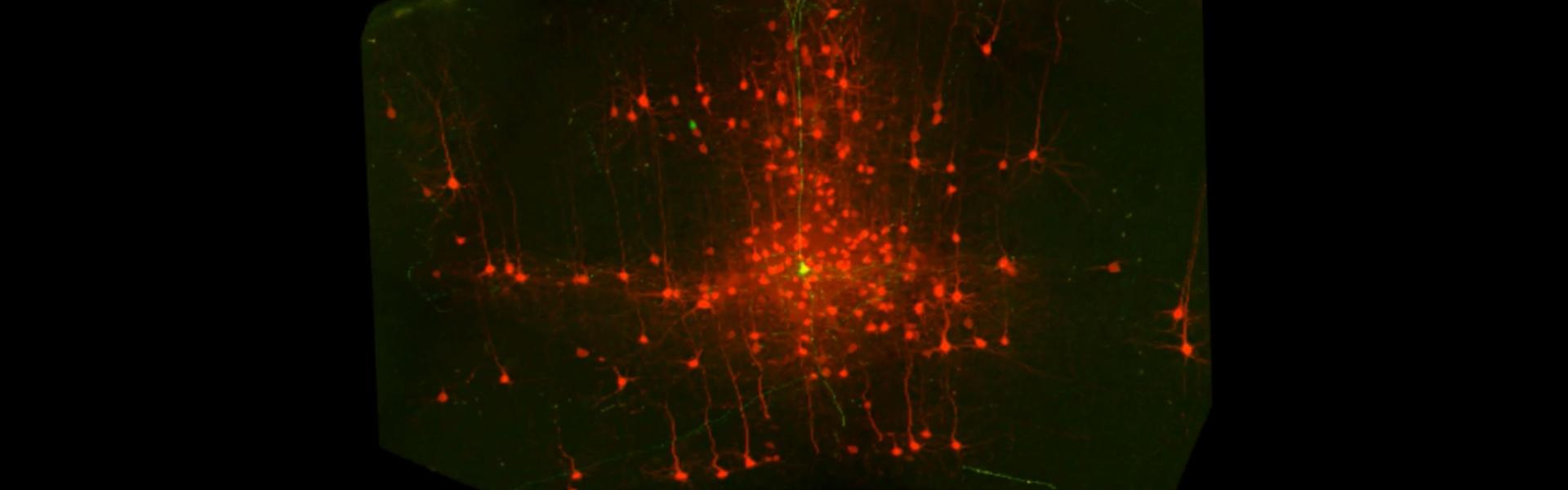 Neurons