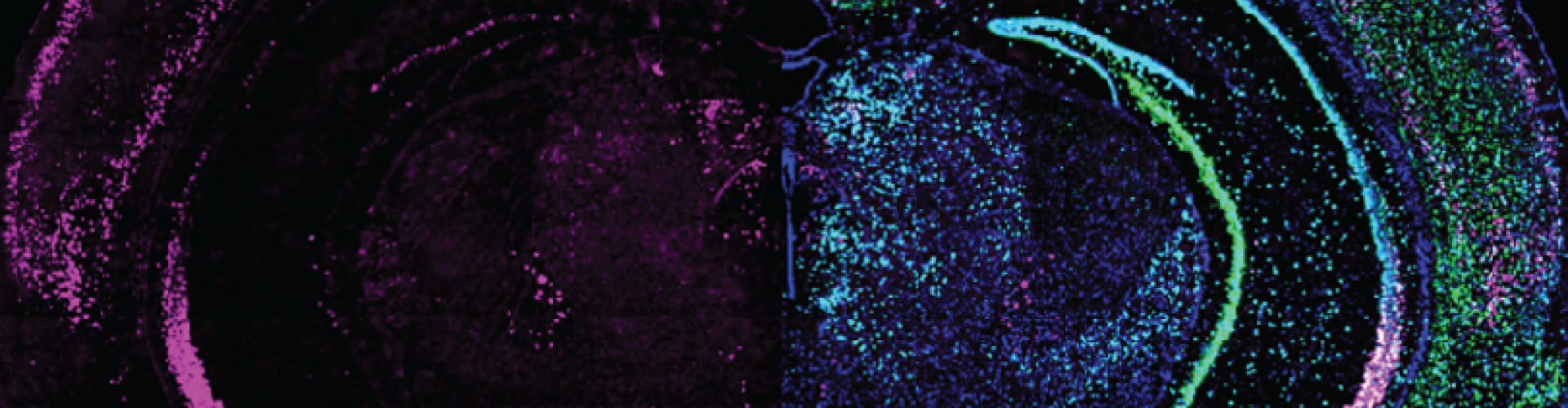 Brain slice - GRP expression (left) different cell markers (right)