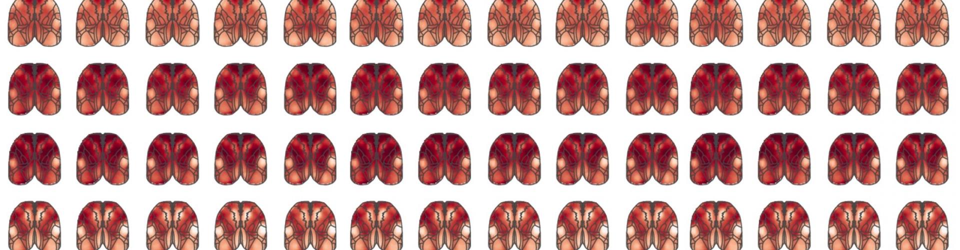 Widefield calcium responses across dorsal cortex in mice