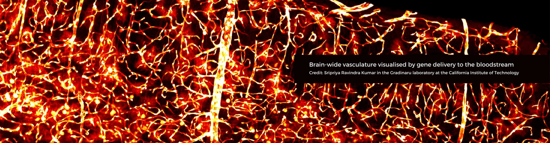 Brain-wide vasculature visualized by gene delivery to the bloodstream. Credit: Sripriya Ravindra Kumar in the Gradinaru laboratory at the California Institute of Technology