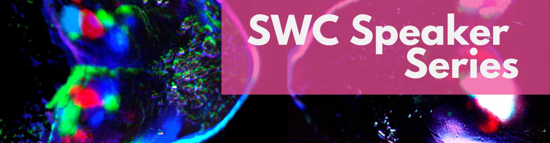 M1. Cortical spontaneous activity at birth in a control mouse (left) and a mouse where retinal waves were blocked by carbenoxolone injection into the eye (right). Text overlaid SWC Speaker Series